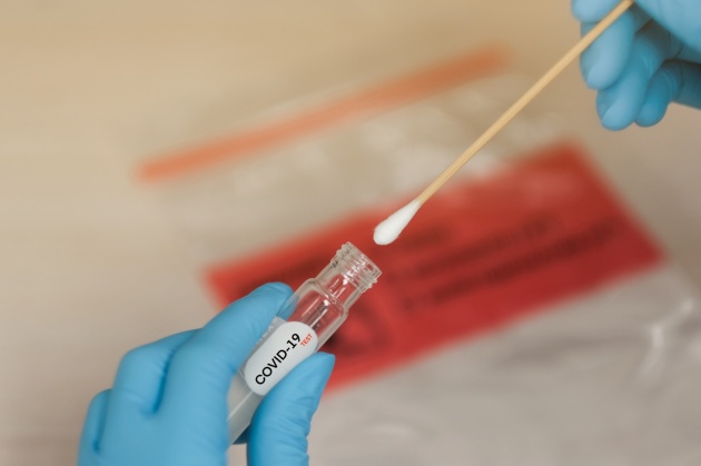 tampone_Coronavirus